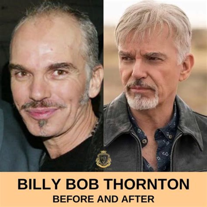 Billy Bob Thornton biography- Does he suffers a mental condition