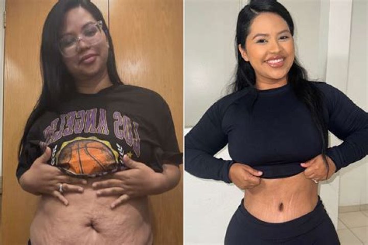 Yung Miami BBL Surgery: Before And After Photos